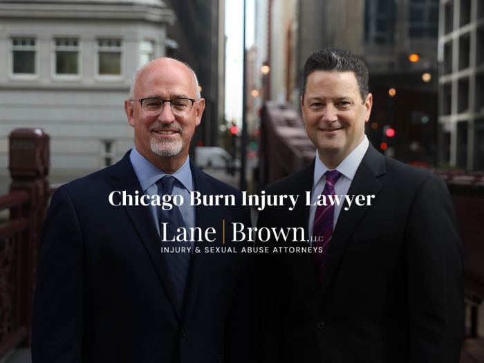 Lawyer seattle injury accident burn ptsd amputation malpractice pedestrian served locations wrongful brain bite bus washington western medical death dog