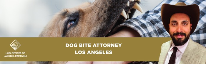 West covina dog bite attorney