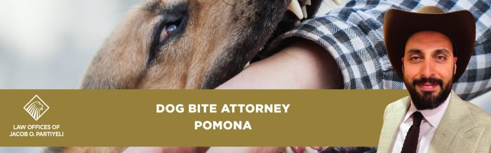 Dog bite attorneys bakersfield