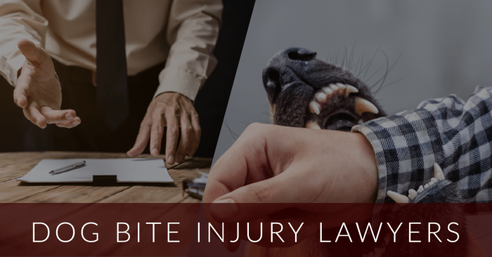 Irvine dog bite attorney